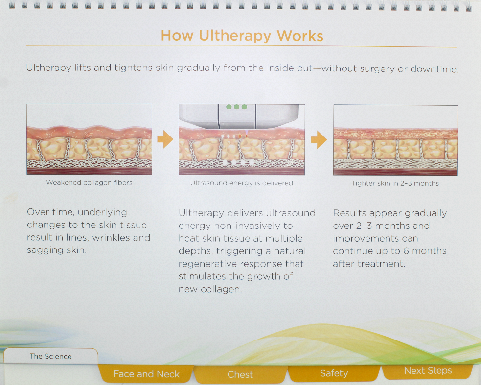 Ulthera Ultherapy Patient Consultation How Ultherapy Works Customer Training
