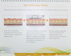 Ulthera Ultherapy Patient Consultation How Ultherapy Works Customer Training