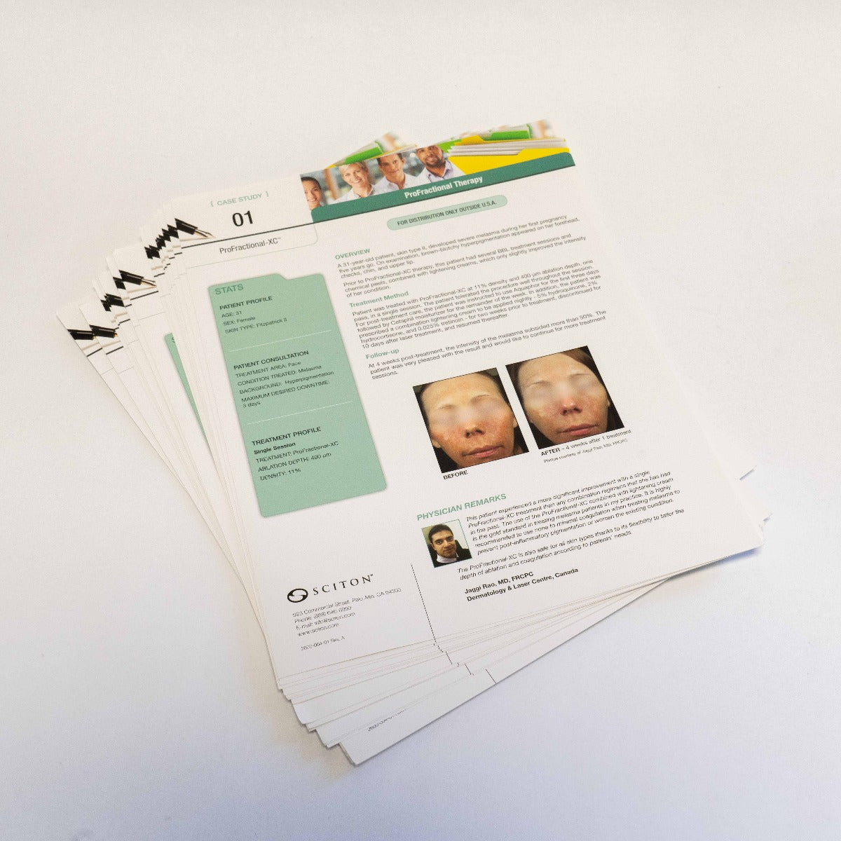 Sciton Joule Surgical Laser Platform ProFractional Therapy - Case Study Pamphlet