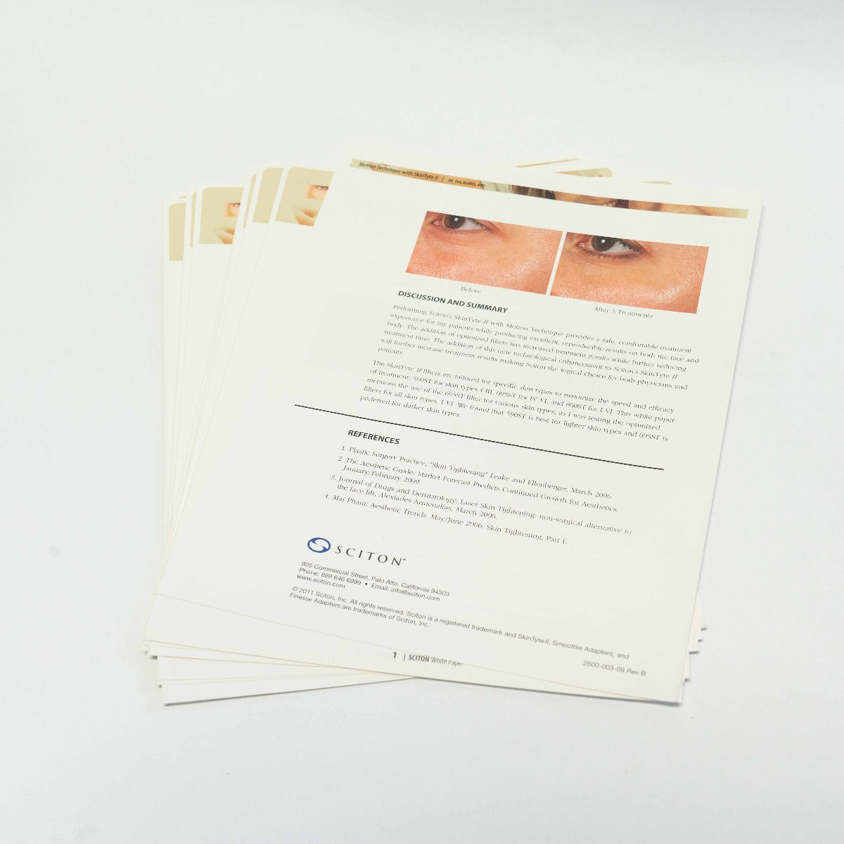 2011 Sciton White Paper - Motion Technique With SkinTyte II - 2600-003-09