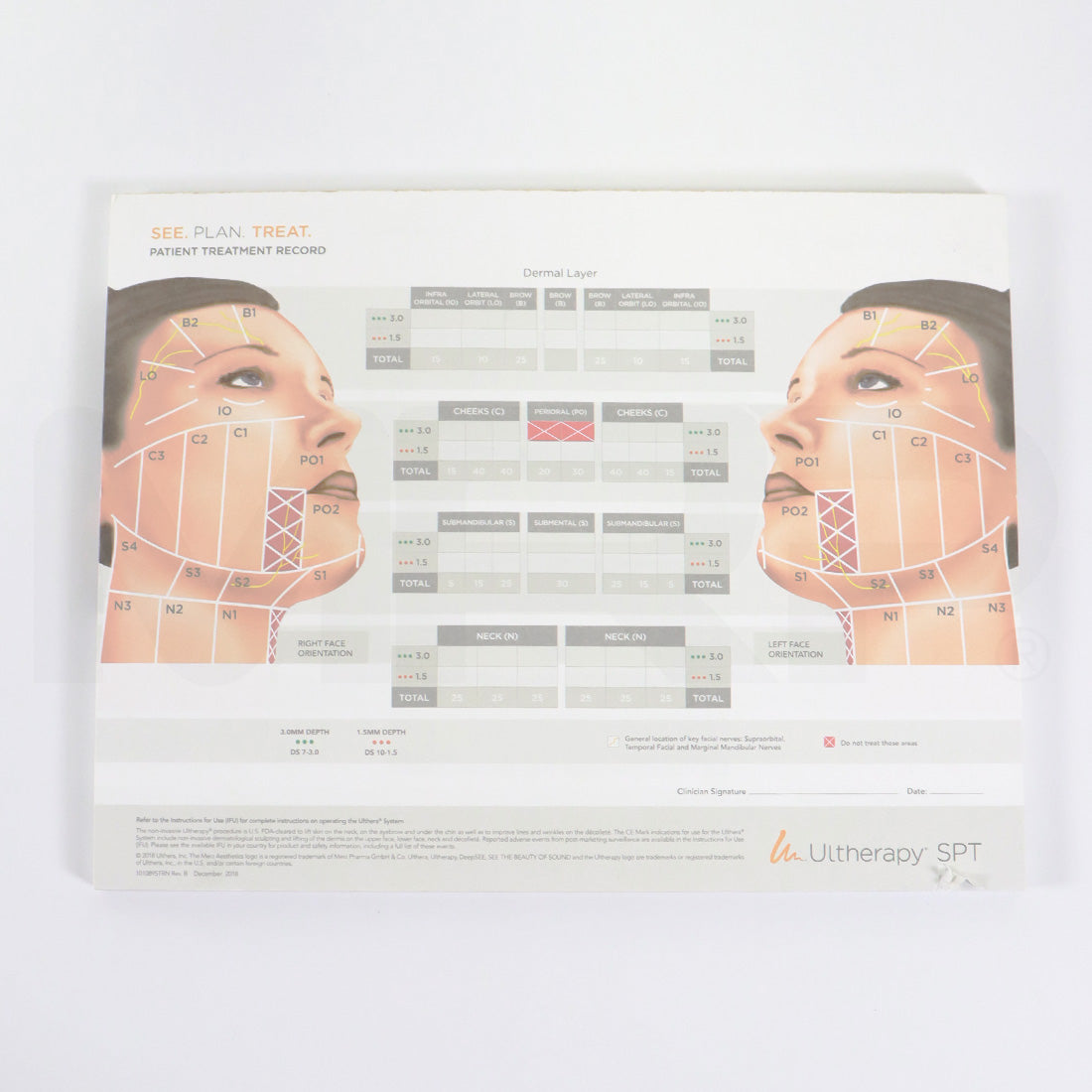 Ulthera Ultherapy Face Patient Treatment Record Forms 1010895TRN, x50 Sheets