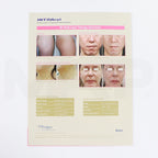 Jeisys Intracel Fractional RF Microneedling Brochure 37x Pack