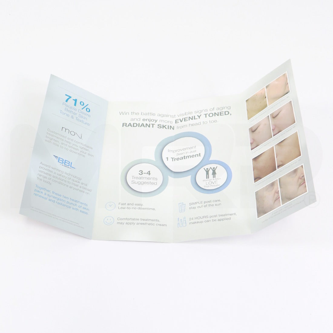 Sciton BBL Hero Moxi Skin Treatment Patient Marketing Brochures, New 25-Pack