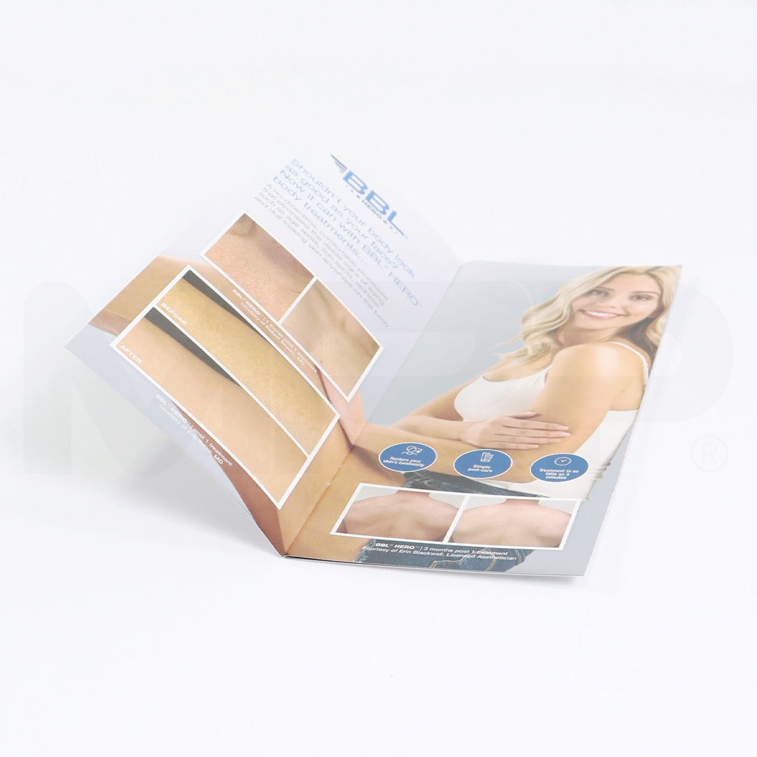 Sciton BBL Hero Beautiful Skin Head To Toe Marketing Brochure, 11-Pack