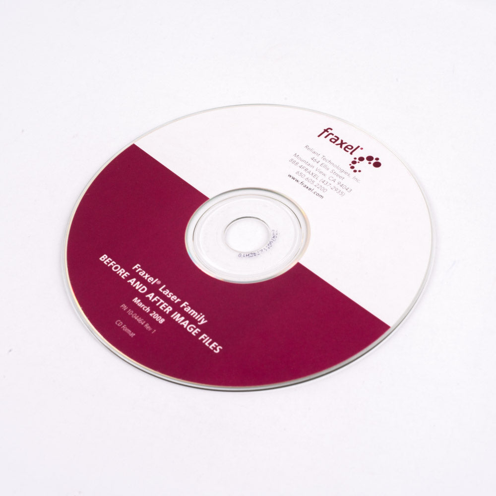 Fraxel Laser Family - Before & After Image Files Data Disk - PN 10-04464 Rev 1