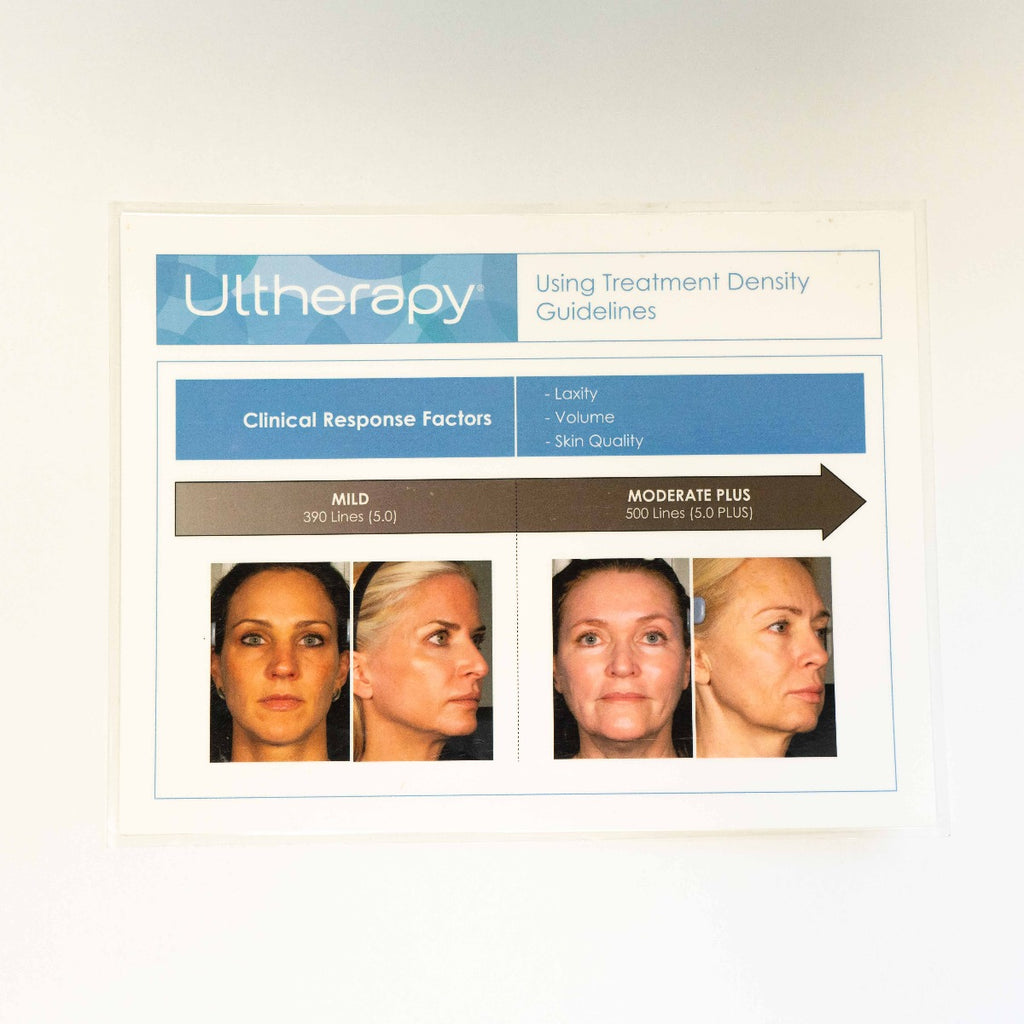 Ulthera Ultherapy Treatment Density Guideline Laminated Chart w/ Photos