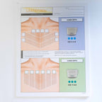 Ulthera Ultherapy Chest Patient Record Informational Double Sided Form 1001286C