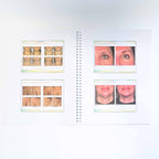 Ulthera Ultherapy Customer Training & Information Book w/ B&A Photos 1003213TRN