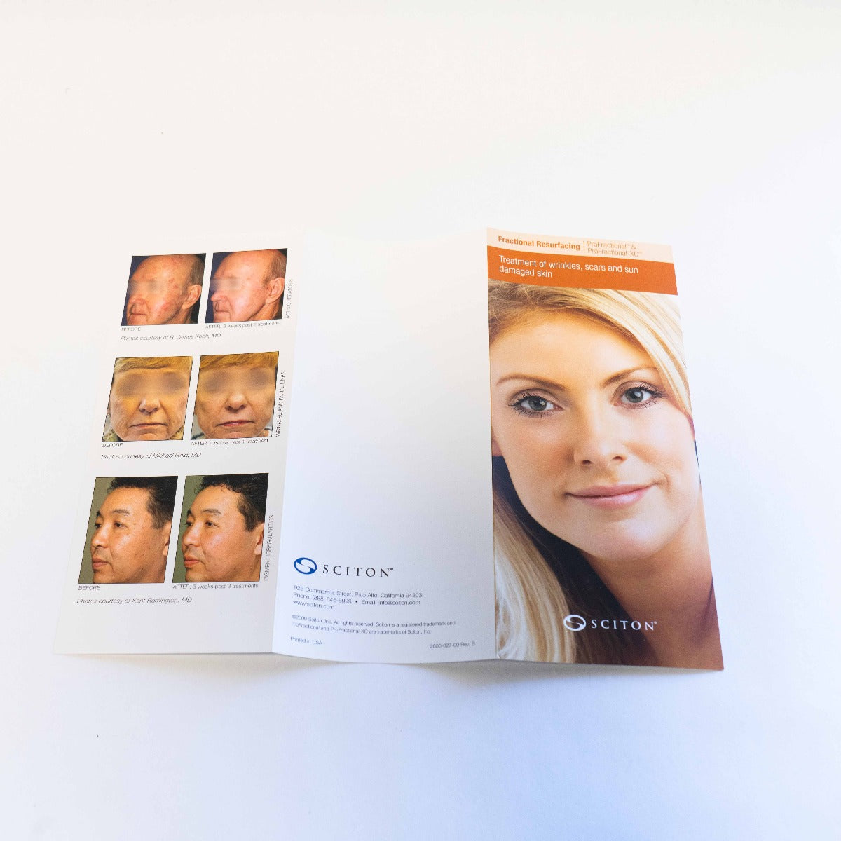 Sciton ProFractional Information Brochure with Patient Photos - XF Pamphlet