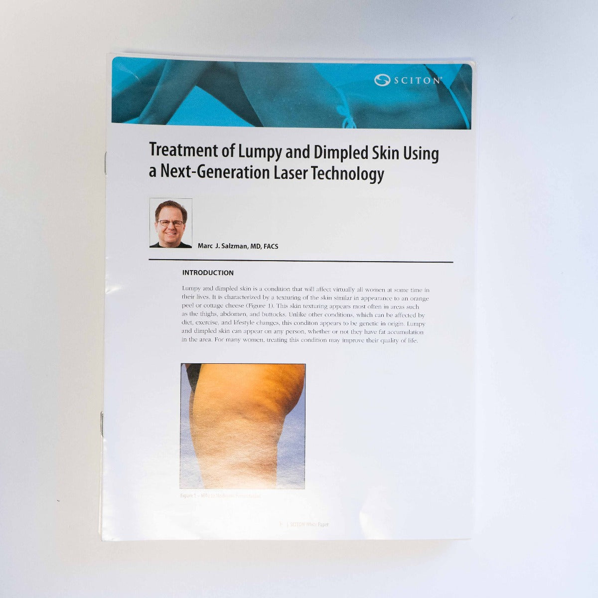 Sciton - Treatment of Lumpy and Dimpled Skin - Case Study / Information Booklet
