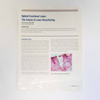 Sciton HALO: Hybrid fractional laser: Case Study Booklet - Patient Marketing Book