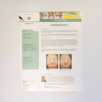 Sciton Joule Surgical Laser Platform ProFractional Therapy - Case Study Pamphlet