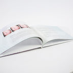 Sciton Halo Fractional Laser Patient Office Marketing Before After Photos Book