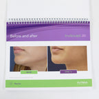 2018 Cutera TruSculpt 3D Patient Informational Standing Display Booklet AP1732