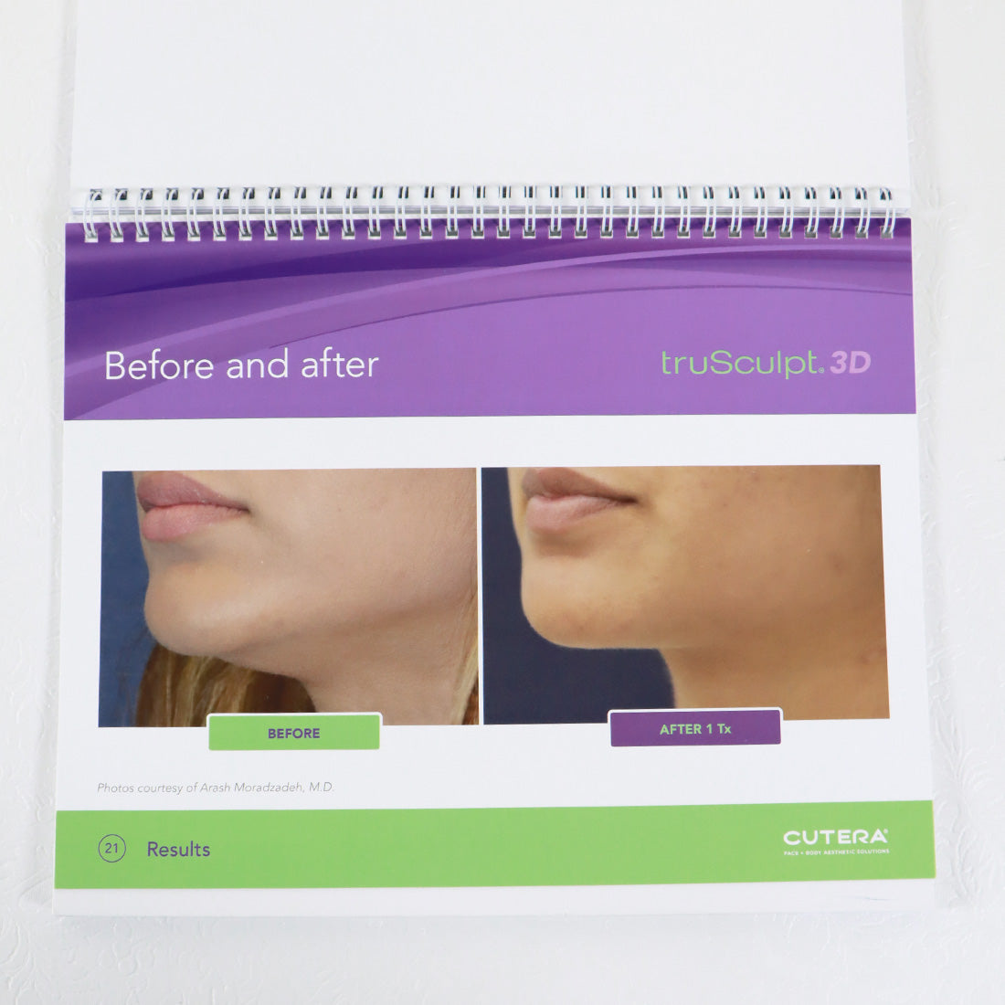 2018 Cutera TruSculpt 3D Patient Informational Standing Display Booklet AP1732