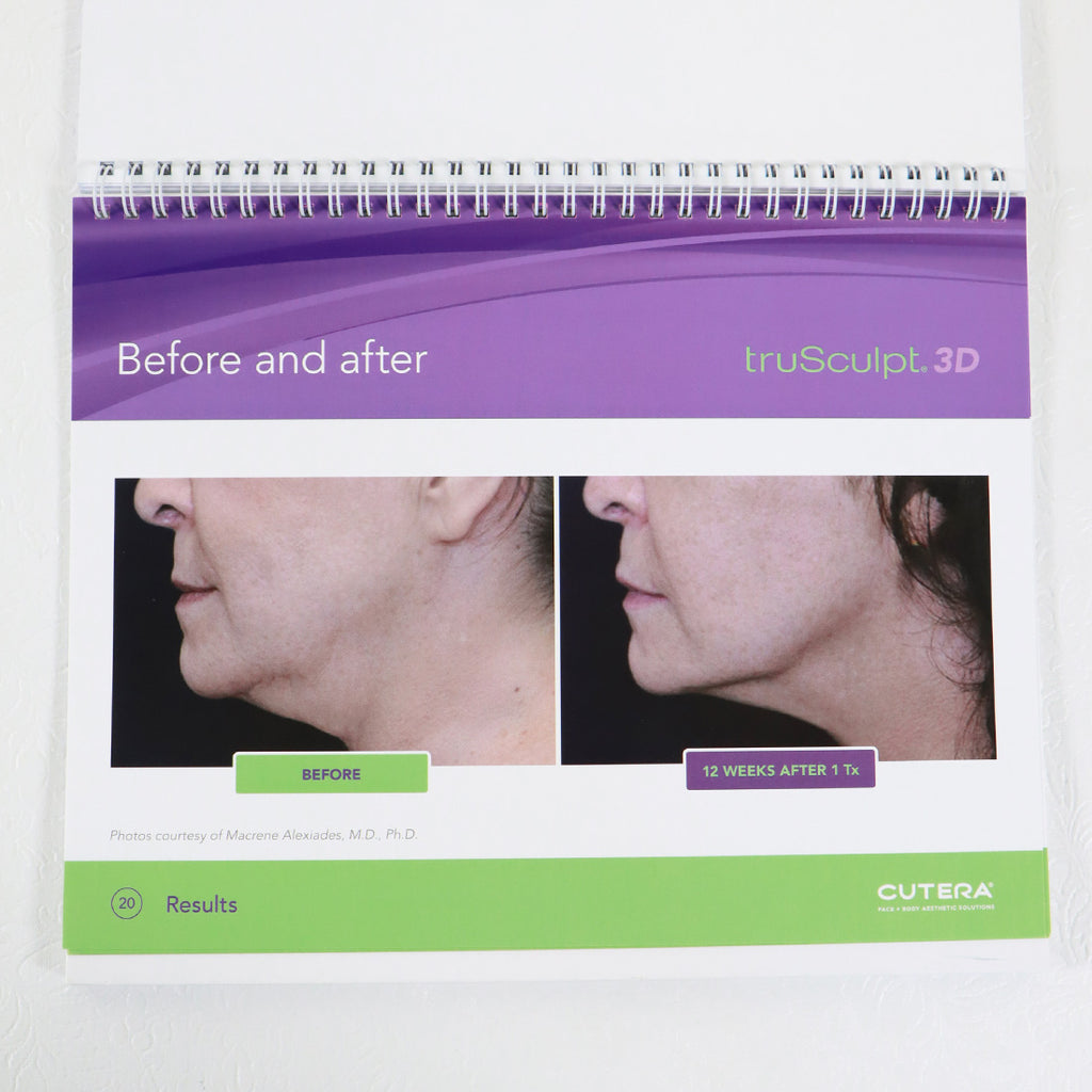 2018 Cutera TruSculpt 3D Patient Informational Standing Display Booklet AP1732