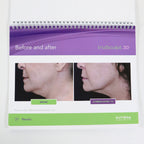 2018 Cutera TruSculpt 3D Patient Informational Standing Display Booklet AP1732