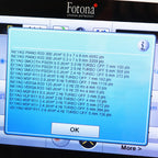 2022 Fotona TimeWalker II Fotona4D Aesthetic Laser System