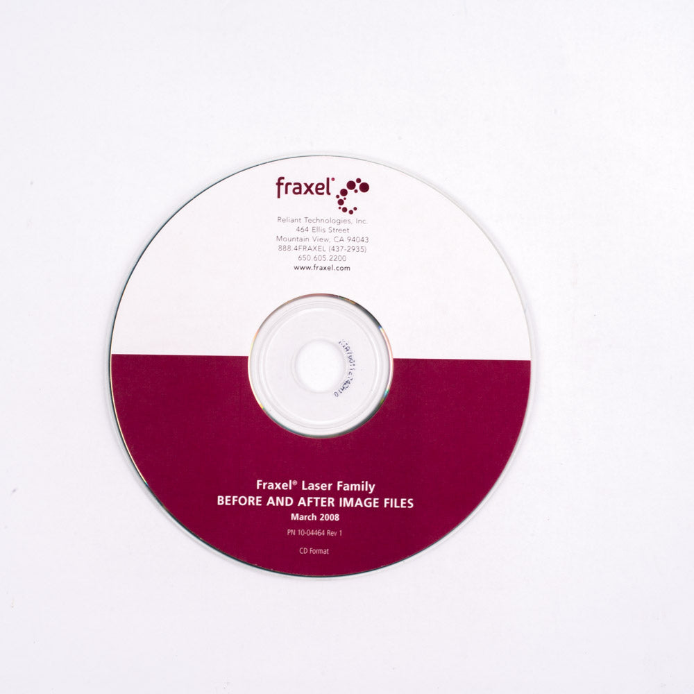 Fraxel Laser Family - Before & After Image Files Data Disk - PN 10-04464 Rev 1