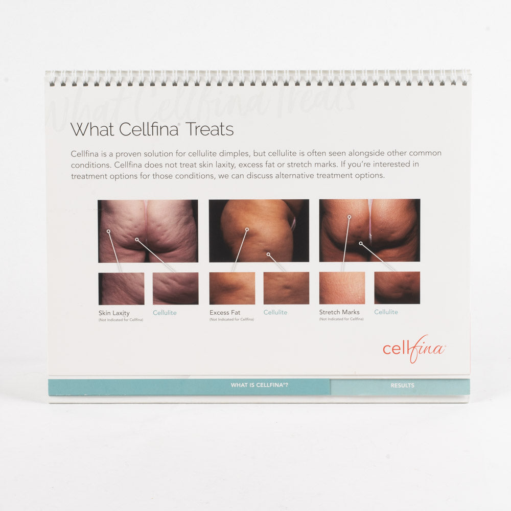 2018 MERZ Cellfina Prop-Up Display Patient Informational Booklet - 17 Pages