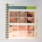 2006 Cutera Workshop Material Book. Solera, Xeo, CoolGlide - D0372 Rev B 0406