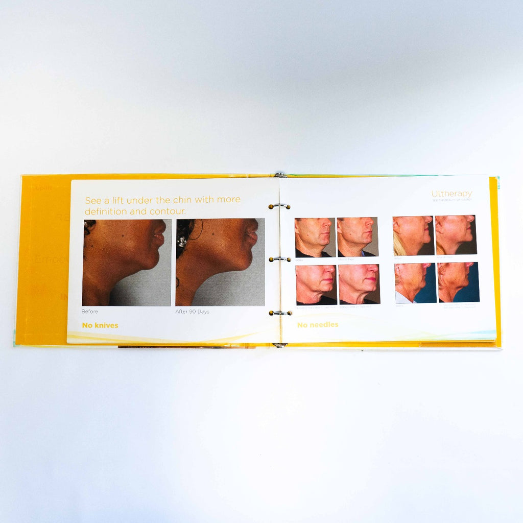 Ultherapy: The Uplifting Solution For Sagging Skin - Treatment Information Book