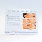 Ulthera Ultherapy - Prop Up Display Treatment Reference Guidelines 1003028E