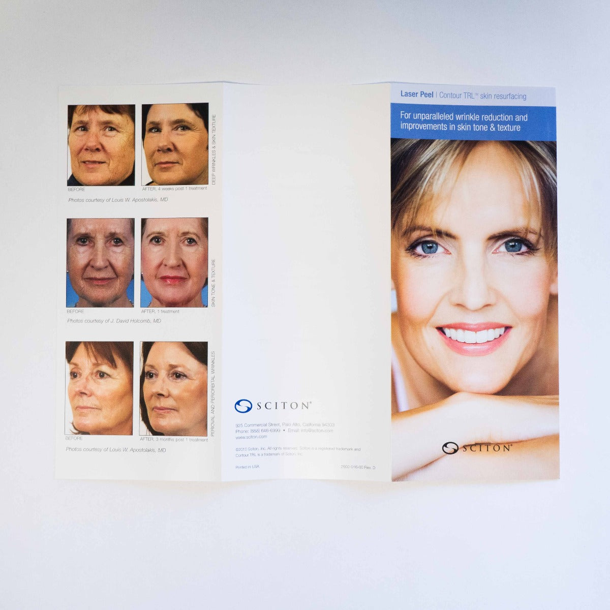 Scition LASER PEEL Contour TRL Information Brochure with Patient Photos Qty. 26