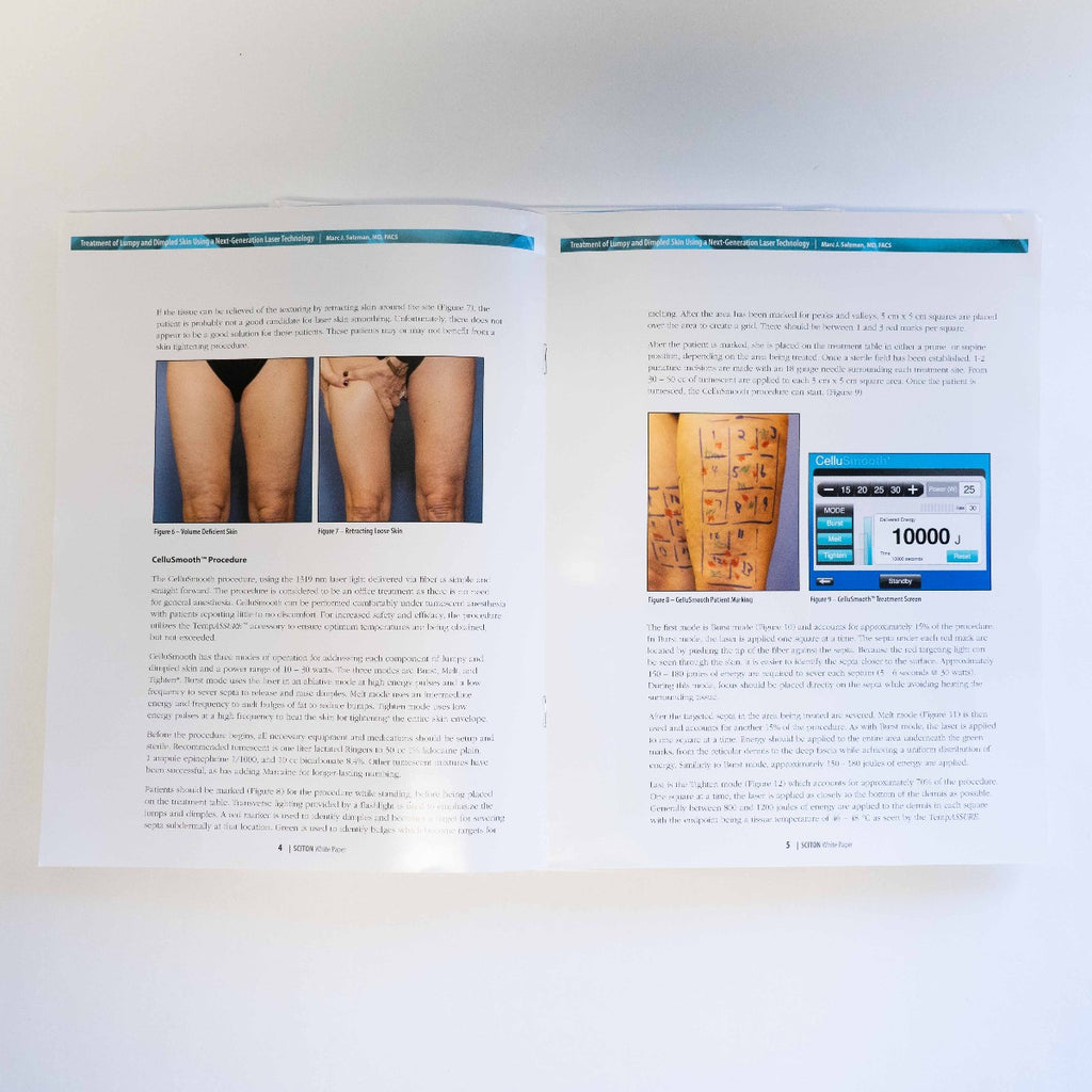 Sciton - Treatment of Lumpy and Dimpled Skin - Case Study / Information Booklet