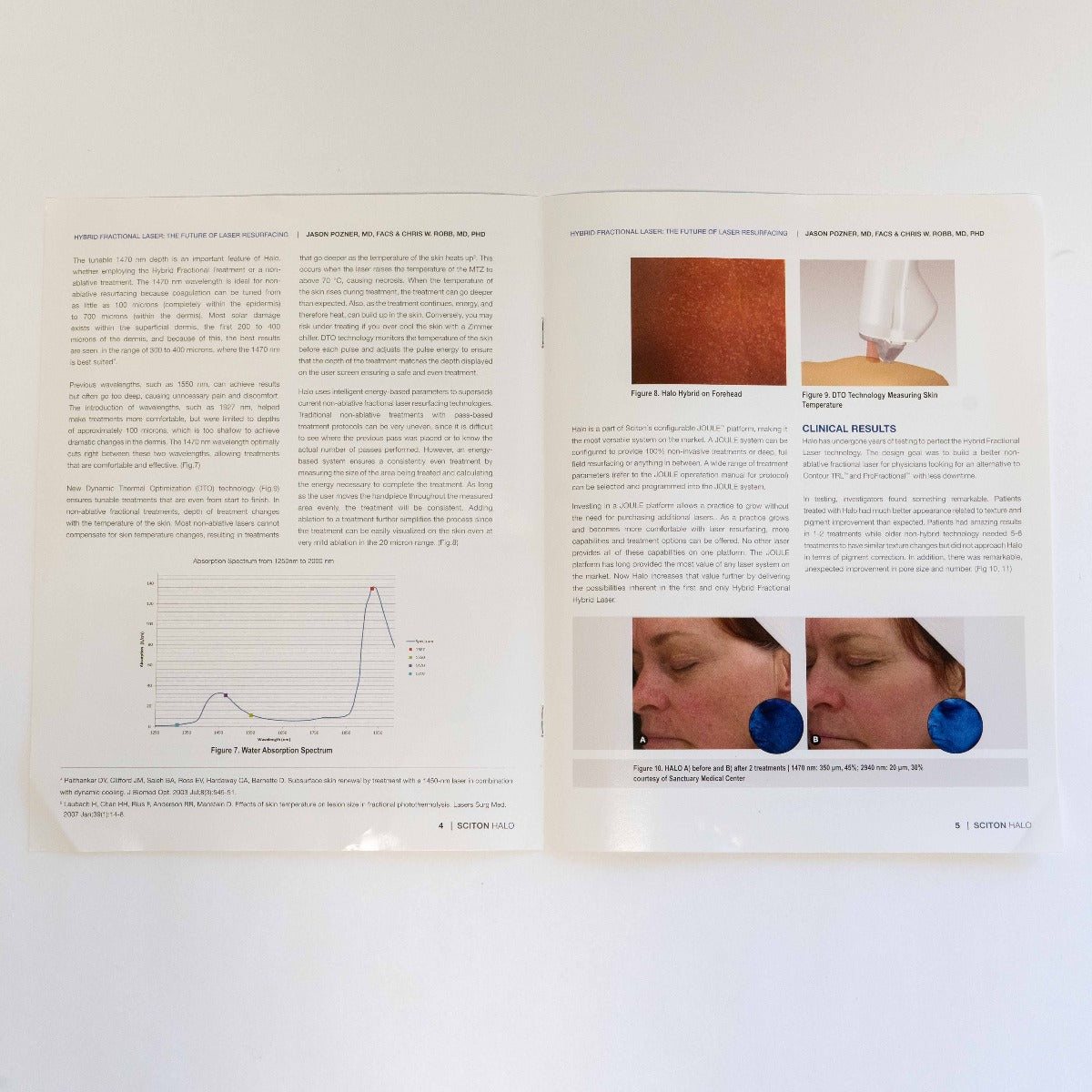 Sciton HALO: Hybrid fractional laser: Case Study Booklet - Patient Marketing Book
