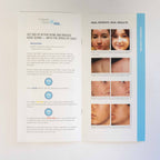 Sciton BBL - Family of Brands Brochure - Forever Young, Clear & Bare + SkinTyte