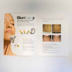 Sciton - Skin Tyte II - 2011 System Information Marketing Booklet - 2600-029-02