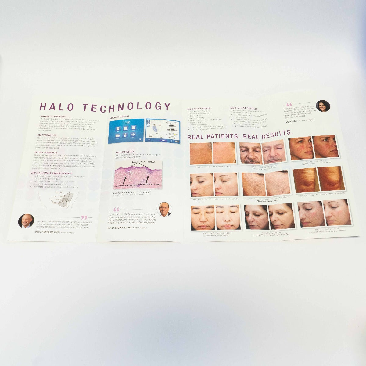2018 Sciton Halo Platform Information & Marketing Foldout Brochure - 2600-029-21