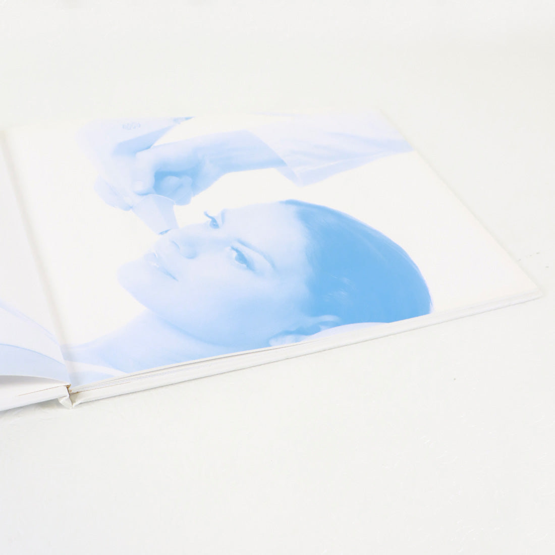 BTL Aesthetics Exilis System Gallery Book Before And After Treatment Pictures