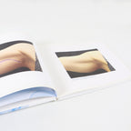 BTL Aesthetics Exilis System Gallery Book Before And After Treatment Pictures