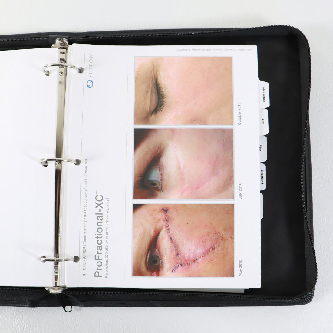 Sciton Seminar Marketing Power Point and Product Description Binder