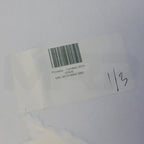 2015 Candela PicoWay Picosecond Laser Tattoo Removal System