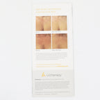 Ulthera Ultherapy Christine Brinkley Patient Info Brochure ML02333-00 25pk