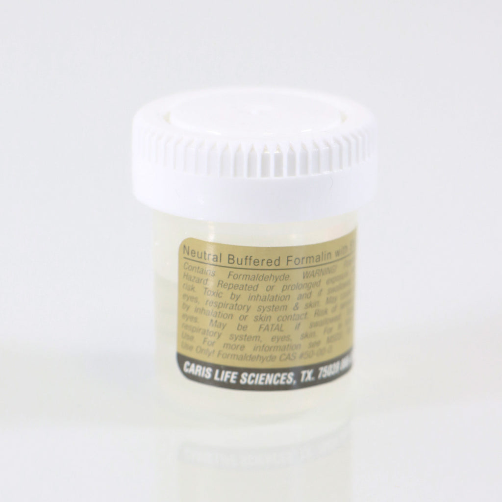 StatLab Specimen Transport Containers 24 x 20ml 24pk Solution Filled