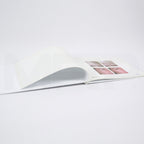 Aerolase Neo Laser Treatment Patient Before After Photos Book Office Marketing