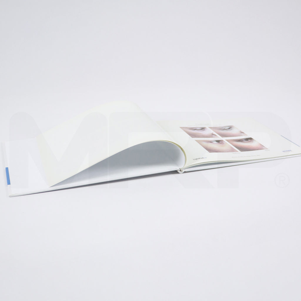 Aerolase Neo Laser Treatment Patient Before After Photos Book Office Marketing