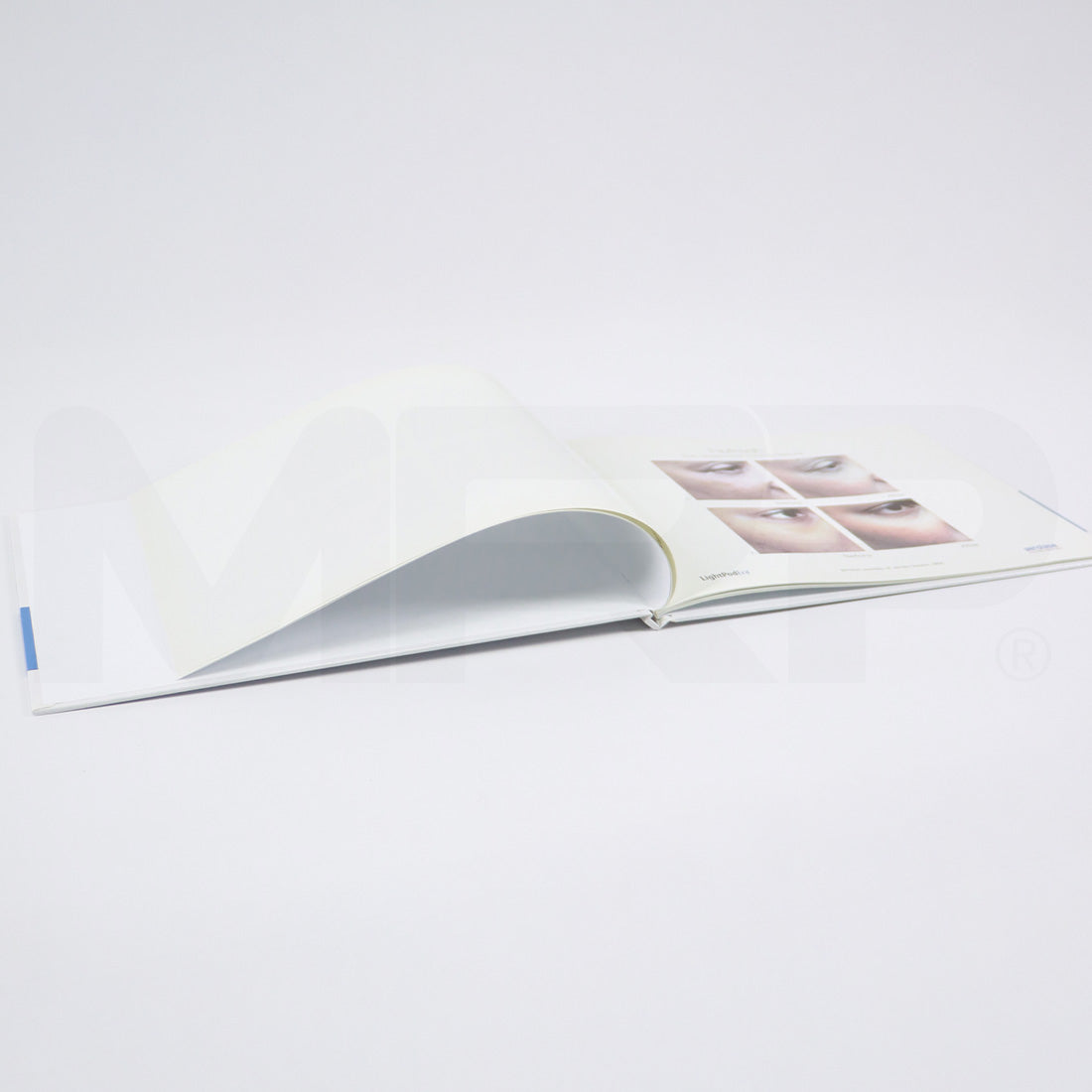 Aerolase Neo Laser Treatment Patient Before After Photos Book Office Marketing