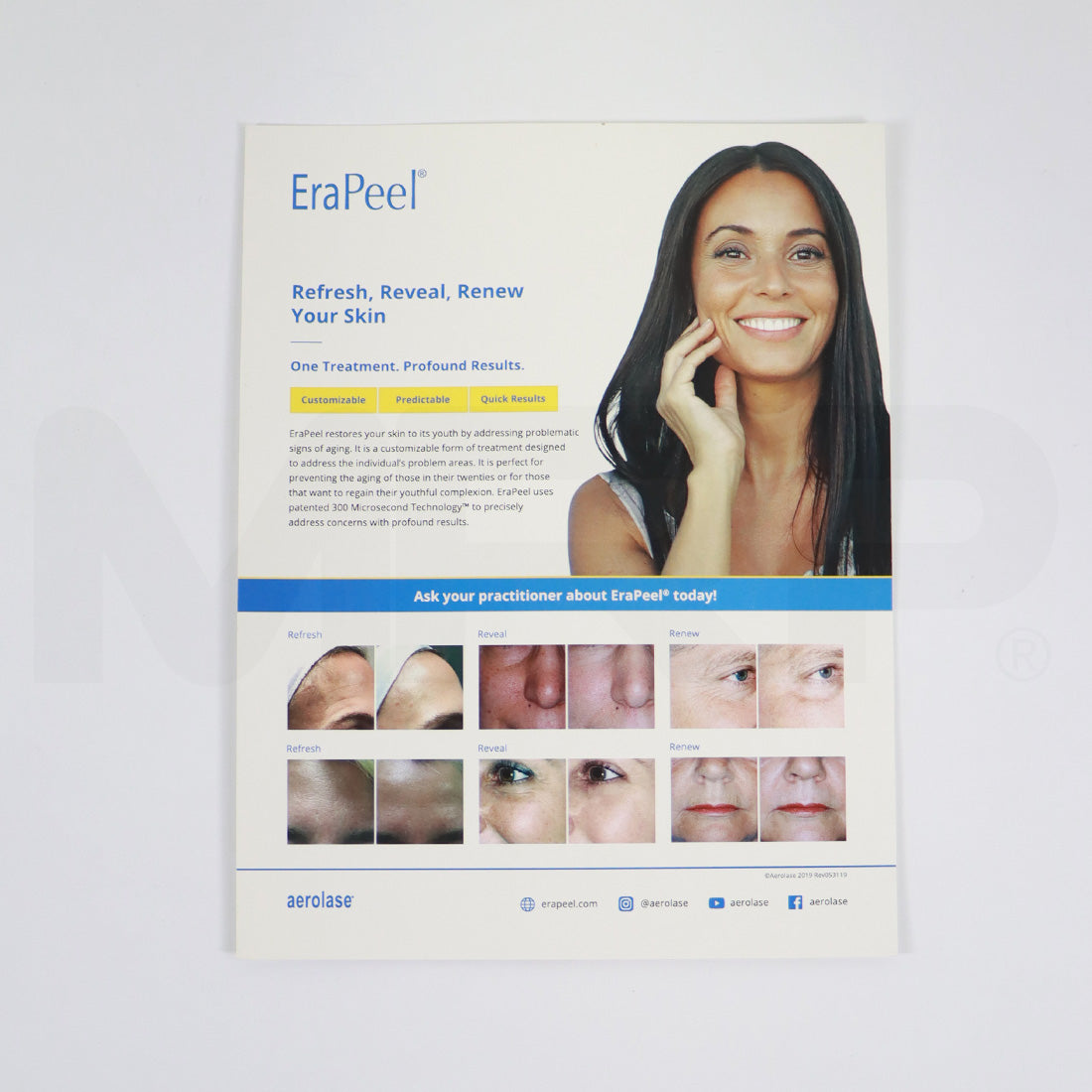 Aerolase EraPeel Counter Card Marketing