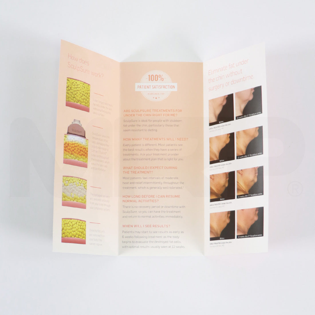 Cynosure Sculpsure 'A Smarter Way to Sculpt' Brochures x9 Pack