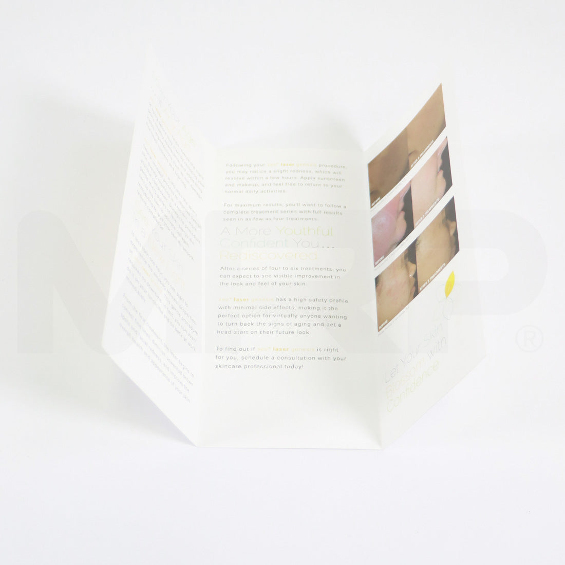 Cutera Xeo Laser Genesis Let Your Skin Blossom With Confidence Brochures x34 Pack