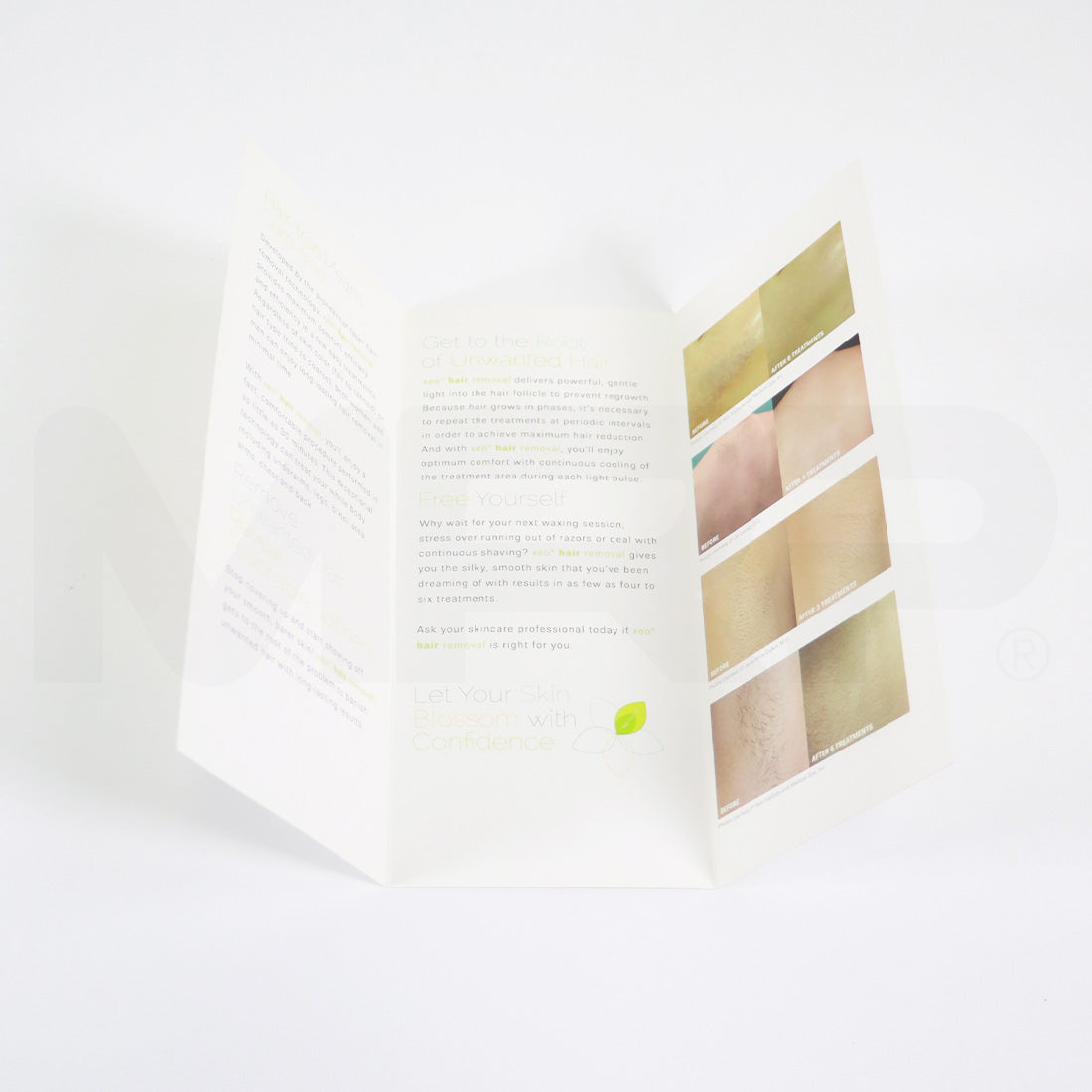 Cutera Xeo Hair Removal Let Your Skin Blossom With Confidence Brochures x20 Pack