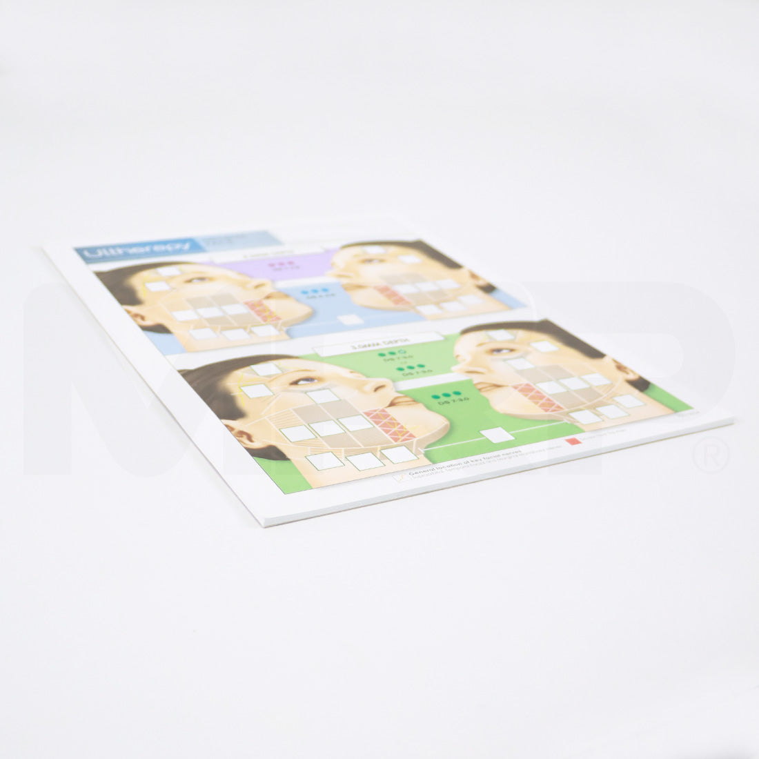 Ulthera Ultherapy Face Patient Record Treatment Form 1001505A 15 Sheets