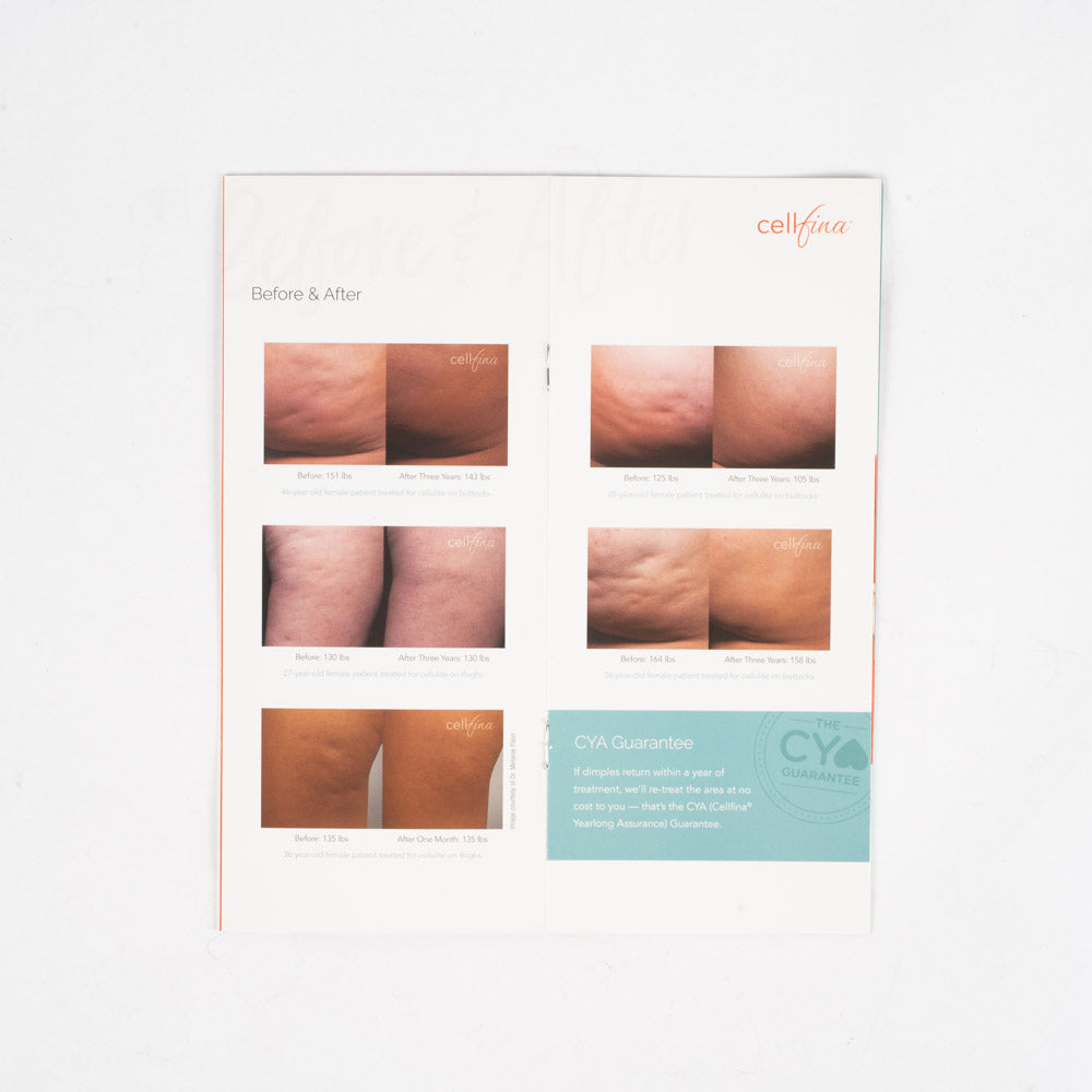 MERZ Aesthetics CellFina Patient Informational Brochure/Pamphlet - Lot of 20