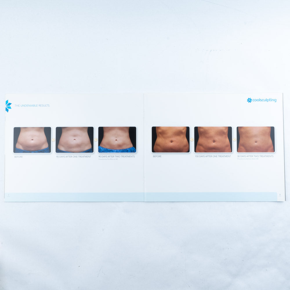 Coolsculpting Show More of Less Patient Informational Before & After Photo Book