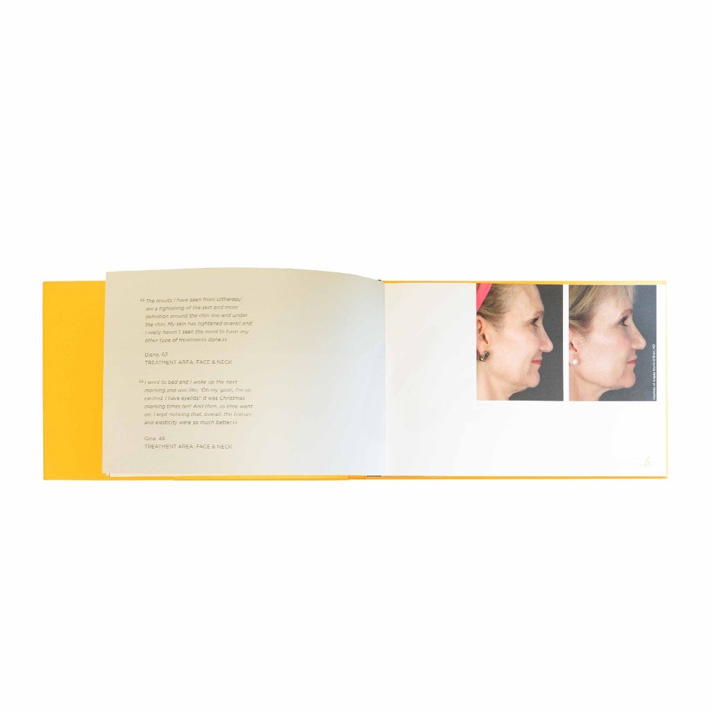 Ulthera Ultherapy Customer Treatment Informational Coffee Table Book 11.5x17.5